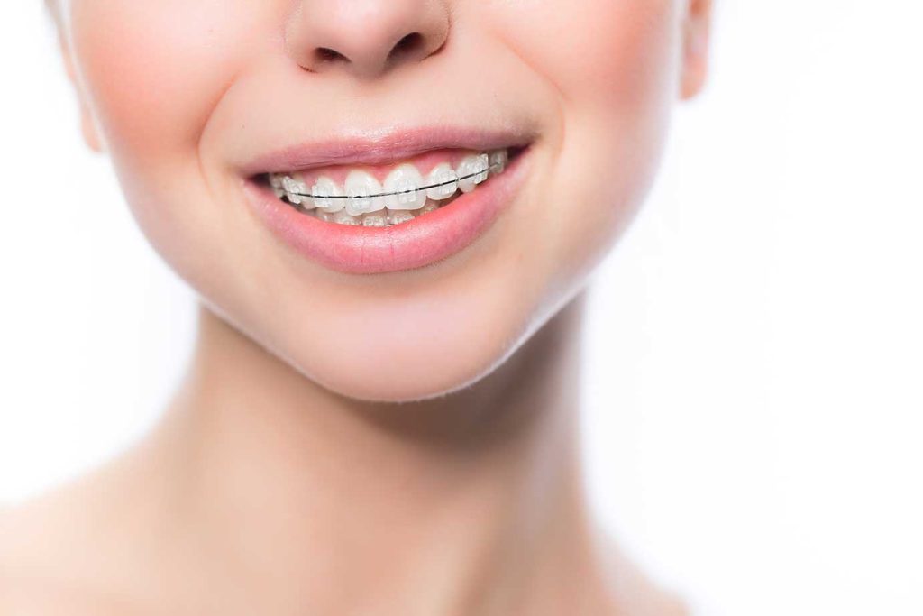 Orthodontist in Menifee