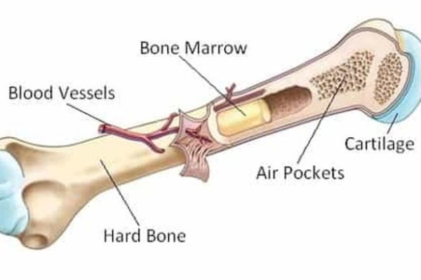 bone marrow transplant