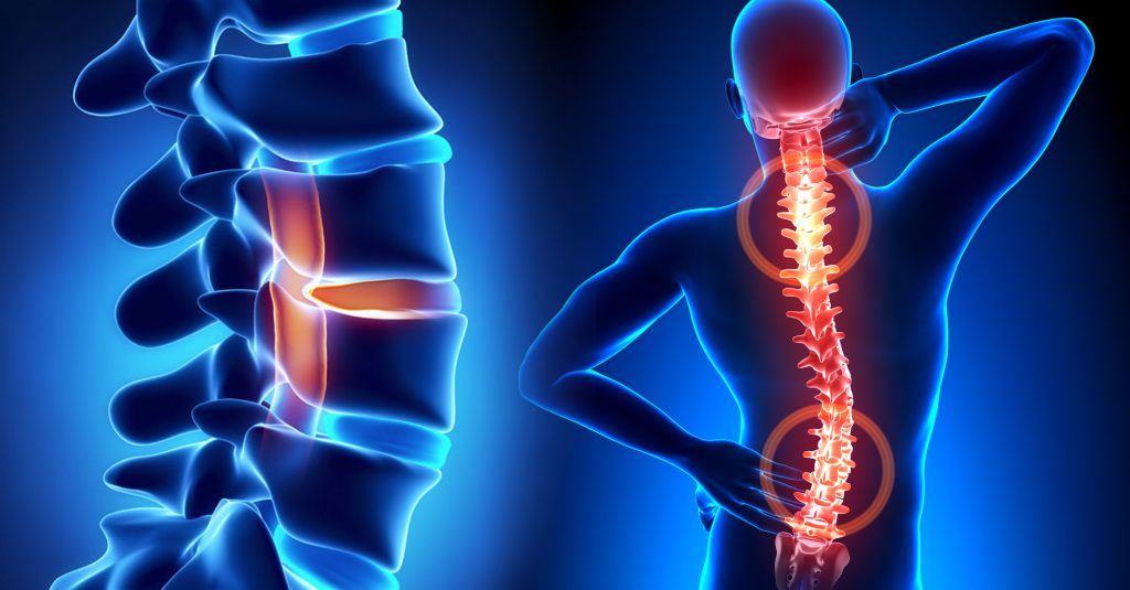 Common Fears About Neuro Spine Surgery and How to Overcome Them