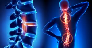 Common Fears About Neuro Spine Surgery and How to Overcome Them