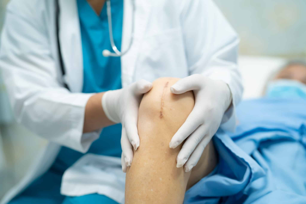 Knee Replacement Surgery in Delhi: Get Back to Moving Comfortably