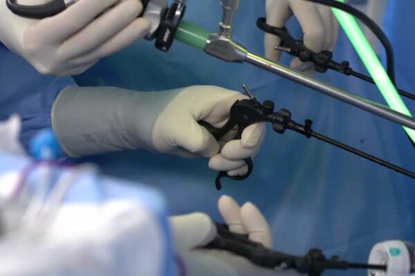 Laparoscopic